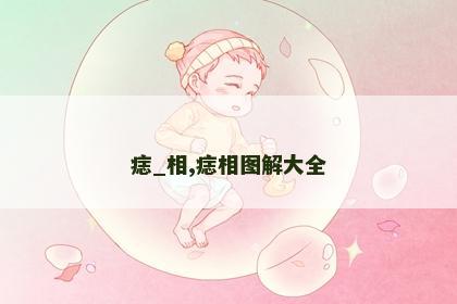 痣_相,痣相图解大全